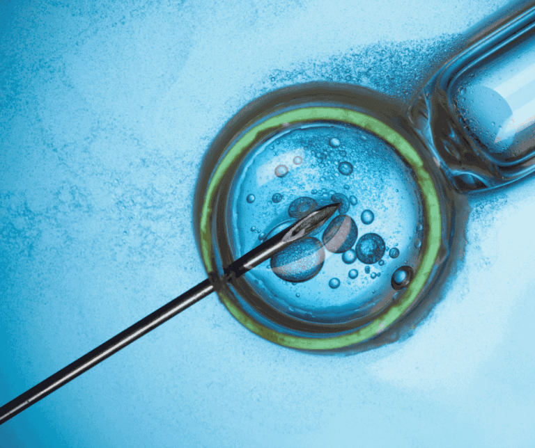 IVF Embryo Transfer